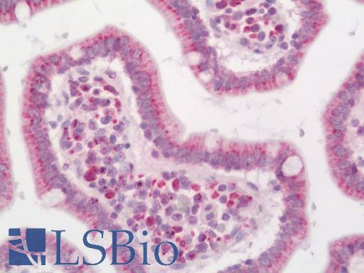 Human Small Intestine: Formalin-Fixed, Paraffin-Embedded (FFPE)