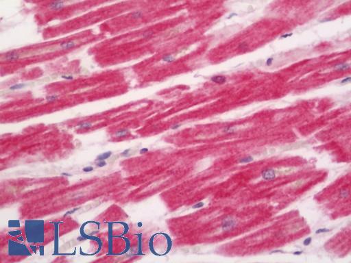 Human Heart: Formalin-Fixed, Paraffin-Embedded (FFPE)