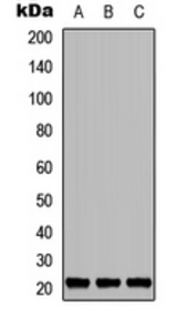 Western blot analysis of TNFAIP8L1 expression in MCF7 (A); Raw264.7 (B); PC12 (C) whole cell lysates.