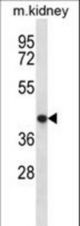 TNMD Antibody western blot of mouse kidney tissue lysates (35 ug/lane). The TNMD antibody detected the TNMD protein (arrow).