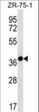 TNMD Antibody western blot of ZR-75-1 cell line lysates (35 ug/lane). The TNMD antibody detected the TNMD protein (arrow).