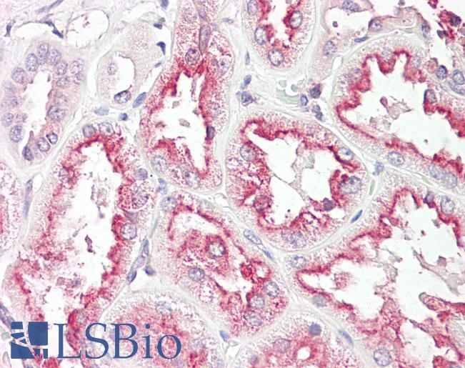 Anti-TNMD / Tenomodulin antibody IHC of human kidney. Immunohistochemistry of formalin-fixed, paraffin-embedded tissue after heat-induced antigen retrieval. Antibody LS-B8193 dilution 2.5-5 ug/ml.