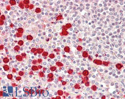 Human Spleen: Formalin-Fixed, Paraffin-Embedded (FFPE)