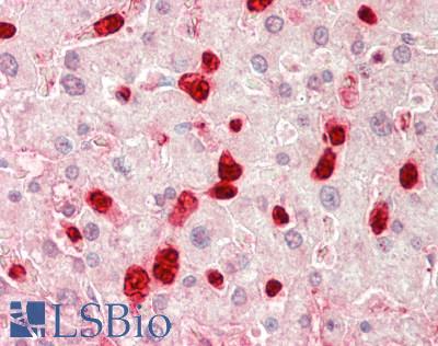 Human Liver: Formalin-Fixed, Paraffin-Embedded (FFPE)