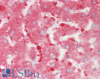 Human Liver: Formalin-Fixed, Paraffin-Embedded (FFPE)