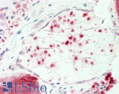 Human Thyroid: Formalin-Fixed, Paraffin-Embedded (FFPE)