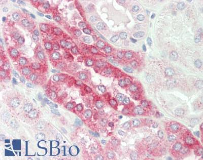 Human Kidney: Formalin-Fixed, Paraffin-Embedded (FFPE)