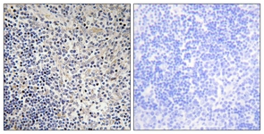 IHC of paraffin-embedded human thymus gland tissue, using TPIP1 Antibody. The picture on the right is treated with the synthesized peptide.