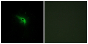 Immunofluorescence of A549 cells, using TPIP1 Antibody. The picture on the right is treated with the synthesized peptide.