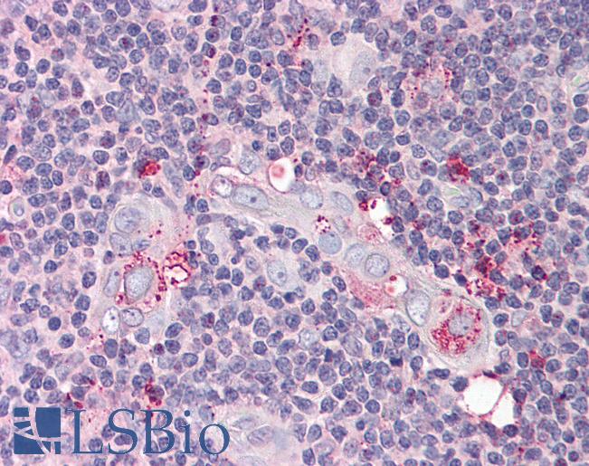 Anti-TP53AIP1 / p53AIP1 antibody IHC of human thymus. Immunohistochemistry of formalin-fixed, paraffin-embedded tissue after heat-induced antigen retrieval. Antibody LS-B536 concentration 5 ug/ml.