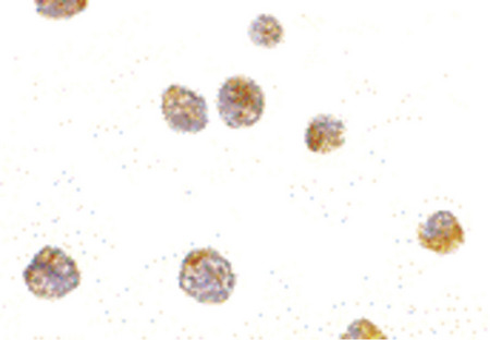 Immunocytochemistry of p53AIP1 in HL60 cells with p53AIP1 antibody at 10 ug/ml.