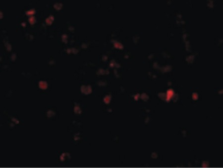 Immunofluorescence of p53AIP1 in HL60 cells with p53AIP1 antibody at 20 ug/ml.