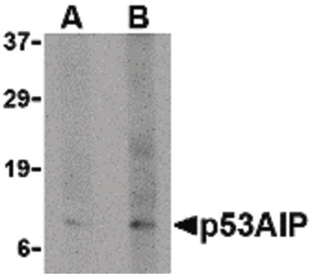 Western blot of p53AIP1 in HL60 cell lysate with p53AIP1 antibody at (A) 4 and (B) 8 ug/ml.