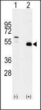 Western blot of TRAF2 (arrow) using rabbit polyclonal TRAF2 Antibody. 293 cell lysates (2 ug/lane) either nontransfected (c) or transiently transfected with the TRAF2 gene (Lane 2) (Origene Technologies).