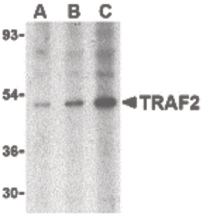 Western blot of TRAF2 in human liver tissue lysate with TRAF2 antibody at (A) 0.5, (B) 1 and (C) 2 ug/ml.