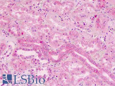 Anti-TRAP / TRAF2 antibody IHC staining of human kidney, tubules. Immunohistochemistry of formalin-fixed, paraffin-embedded tissue after heat-induced antigen retrieval.