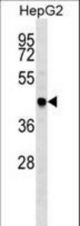 TRAF4 Antibody western blot of HepG2 cell line lysates (35 ug/lane). The TRAF4 antibody detected the TRAF4 protein (arrow).