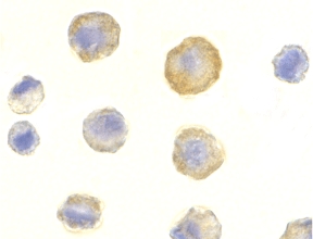 Immunocytochemistry of DcR1 in HeLa cells with DcR1 antibody at 10 µg/ml.