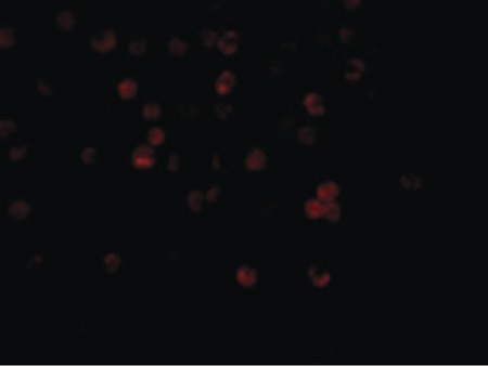 Immunofluorescence of DcR1 in HeLa cells with DcR1 antibody at 20 ug/ml.