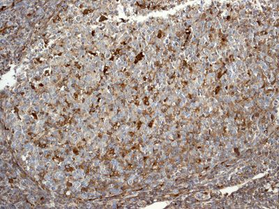 IHC of paraffin-embedded human tonsil tissue using anti-DcR2 antibody.