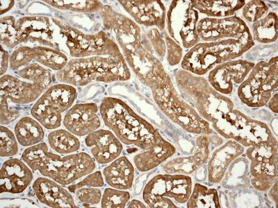 IHC of paraffin-embedded human kidney tissue using anti-DcR2 antibody.