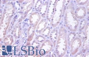 Immunohistochemistry of paraffin-embedded human kidney using TNFRSF10D / TRAIL-R4 / DCR2 antibody at dilution of 1:100.