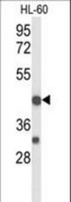 Western blot of TNFRSF10D Antibody in HL-60 cell line lysates (35 ug/lane). TNFRSF10D (arrow) was detected using the purified antibody.
