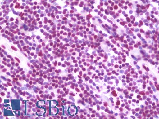 Anti-TRIM28 / KAP-1 antibody IHC staining of human tonsil. Immunohistochemistry of formalin-fixed, paraffin-embedded tissue after heat-induced antigen retrieval. Antibody LS-B10061 concentration 10 ug/ml.