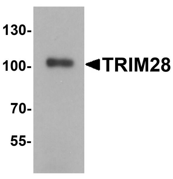 Western blot analysis of TRIM28 in human testis tissue lysate with TRIM28 antibody at 1 ug/ml.