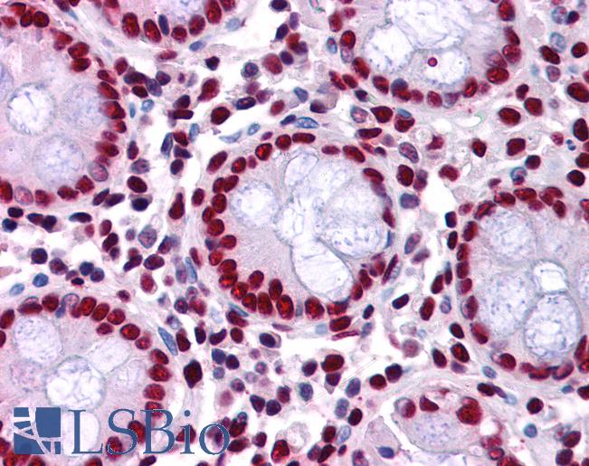 Anti-TRIM28 antibody IHC of human colon. Immunohistochemistry of formalin-fixed, paraffin-embedded tissue after heat-induced antigen retrieval. Antibody LS-B3928 concentration 2.5 ug/ml.