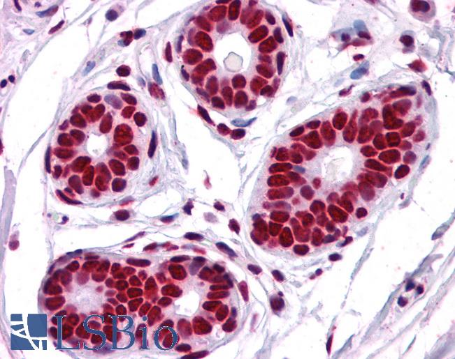 Anti-TRIM28 antibody IHC of human breast. Immunohistochemistry of formalin-fixed, paraffin-embedded tissue after heat-induced antigen retrieval. Antibody LS-B3928 concentration 2.5 ug/ml.