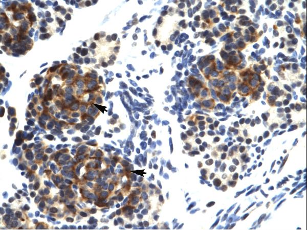 Human Pancreas
