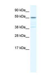 TRIM41 antibody LS-C29975 Western Blot analysis of Fetal liver lysate.