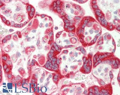 Human Placenta: Formalin-Fixed, Paraffin-Embedded (FFPE)