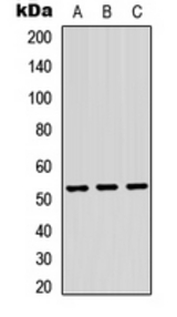 Western blot analysis of TRMT11 expression in HEK293T (A); Raw264.7 (B); PC12 (C) whole cell lysates.