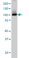 PDE2A monoclonal antibody (M01), clone 4F4 Western Blot analysis of PDE2A expression in IMR-32.