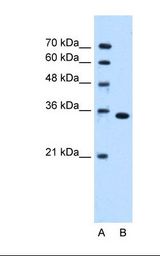 Lane A: Marker. Lane B: Jurkat cell lysate. Antibody concentration: 0.25 ug/ml. Gel concentration: 12%.