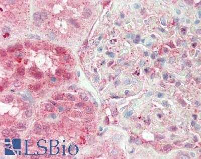Human Kidney: Formalin-Fixed, Paraffin-Embedded (FFPE)