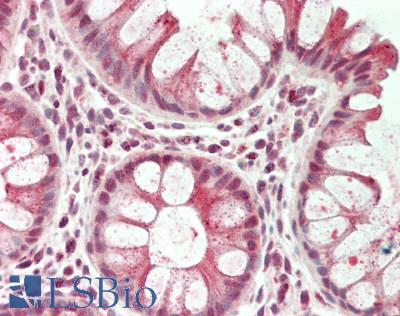 Human Colon: Formalin-Fixed, Paraffin-Embedded (FFPE)