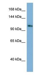 TSC22D1 / TSC22 antibody Western Blot of Human Spleen.