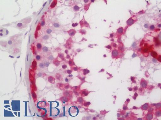 Human Testis: Formalin-Fixed, Paraffin-Embedded (FFPE)