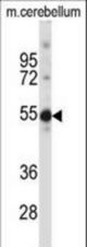 TSPYL5 Antibody western blot of mouse cerebellum tissue lysates (35 ug/lane). The TSPYL5 antibody detected the TSPYL5 protein (arrow).