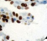 IHC of TTF-1 on FFPE Lung tissue.