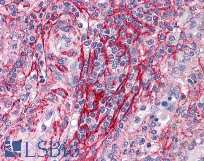 Anti-TBXA2R antibody IHC of human spleen. Immunohistochemistry of formalin-fixed, paraffin-embedded tissue after heat-induced antigen retrieval. Antibody LS-B4842 concentration 10 ug/ml.