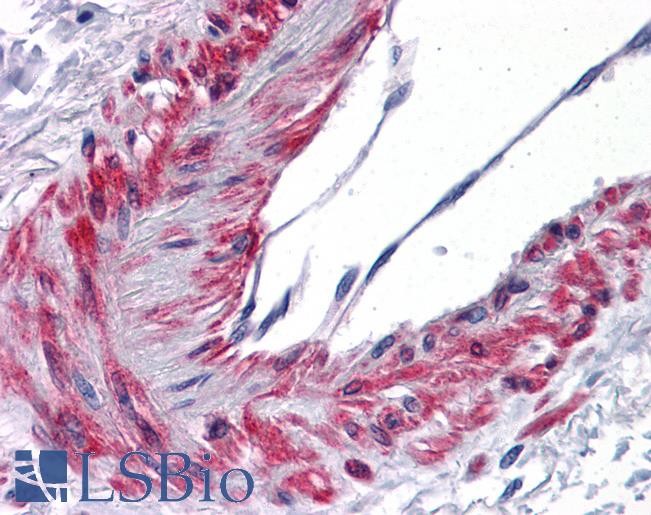 Anti-TBXA2R antibody IHC of human vessel. Immunohistochemistry of formalin-fixed, paraffin-embedded tissue after heat-induced antigen retrieval. Antibody LS-B4842 concentration 10 ug/ml.