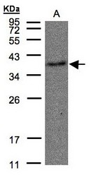 Sample(30 g of whole cell lysate). A: Raji. 12% SDS PAGE. TBXA2R antibody diluted at 1:500.