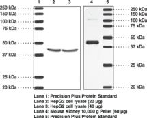 Western blot of Thromboxane A2 Receptor antibody LS-C146680.