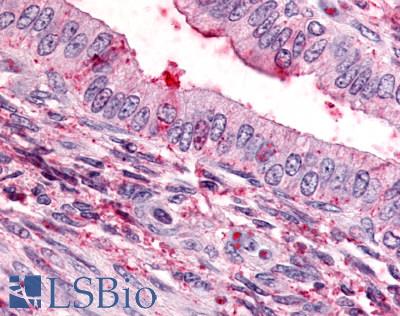 Anti-TBXA2R antibody LS-A1278 IHC of human uterus, endometrium. Immunohistochemistry of formalin-fixed, paraffin-embedded tissue after heat-induced antigen retrieval.