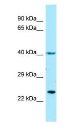 TBXA2R/Thromboxane A2 Receptor antibody Western Blot of Fetal Brain.