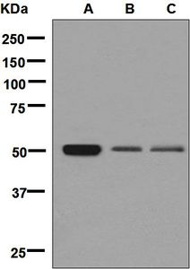 Western blot analysis on (A) human platelet, (B) fetal kidney, and (C) fetal heart lysates using anti-TBXA2R antibody.